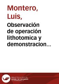 Observación de operación lithotomica y demonstracion anatomica operada, y demonstrada en el insigne hospital del el espiritu santo de calle colcheros / por don Luis Montero ... | Biblioteca Virtual Miguel de Cervantes