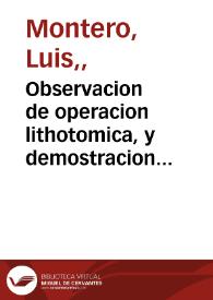 Observacion de operacion lithotomica, y demostracion anatomica operada, y demostrada en el insigne hospital de el espiritu santo, llamado vulgarmente de calle Colcheros / por Luis Montero .. | Biblioteca Virtual Miguel de Cervantes